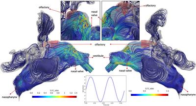 Pulsatile Bi-Directional Aerosol Flow Affects Aerosol Delivery to the Intranasal Olfactory Region: A Patient-Specific Computational Study